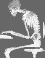 X-ray image of person stooped at a computer