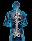 Medical photo showing skeleton within torso