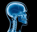 X-ray of human head and neck